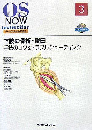上肢の骨折・脱臼 : 手技のコツ&トラブルシューティング 楽天ブックス: 上肢の骨折・脱臼手技のコツ＆トラブル